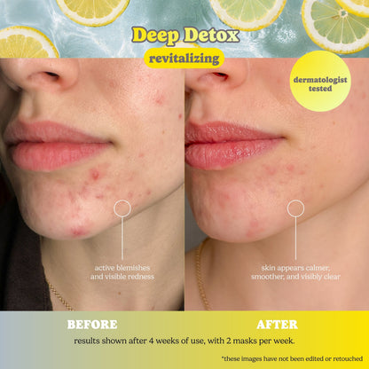 Deep Detox Pore Control Raw Juice Mask